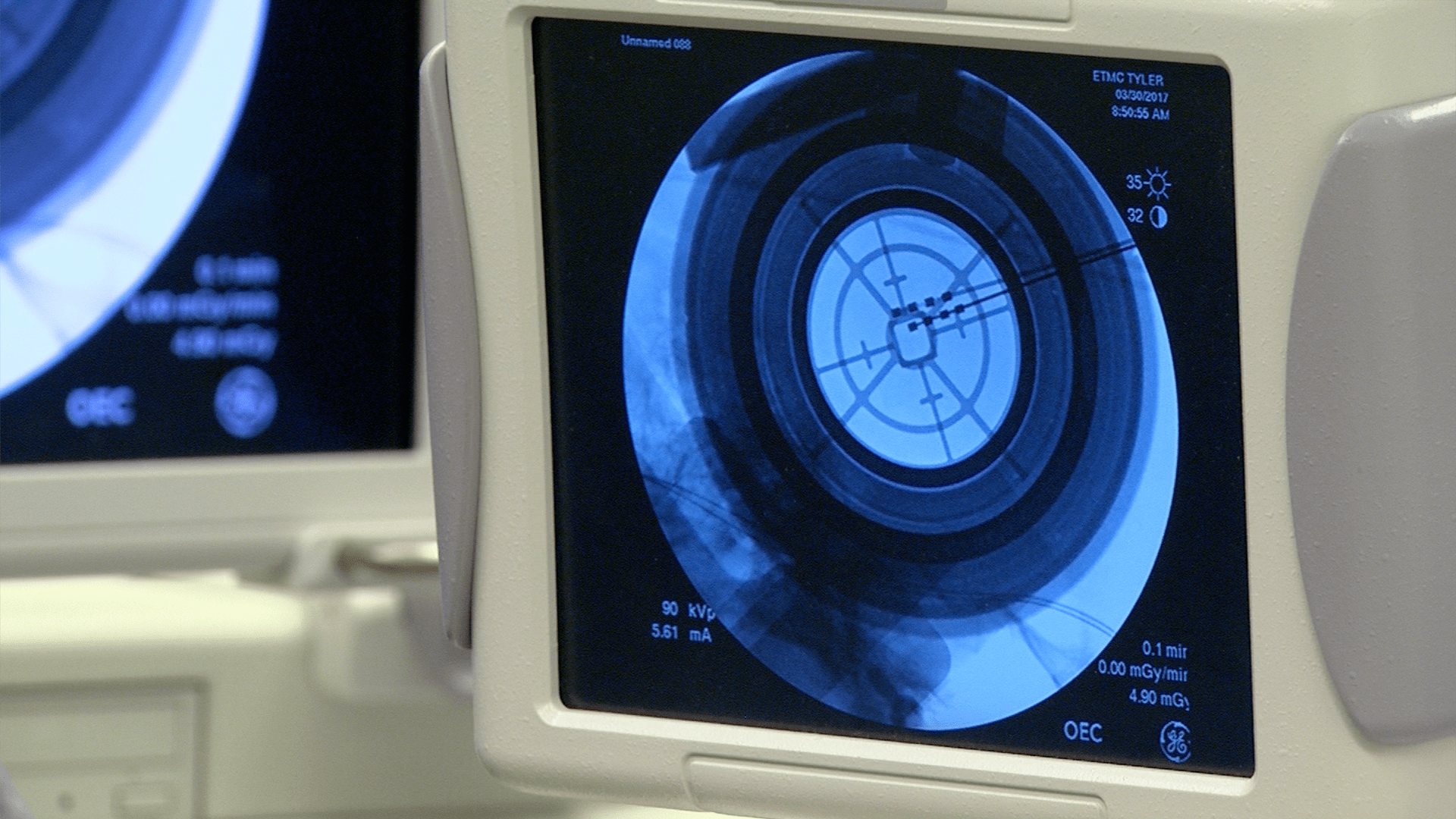 Rockin' And Rollin' with Deep Brain Stimulation