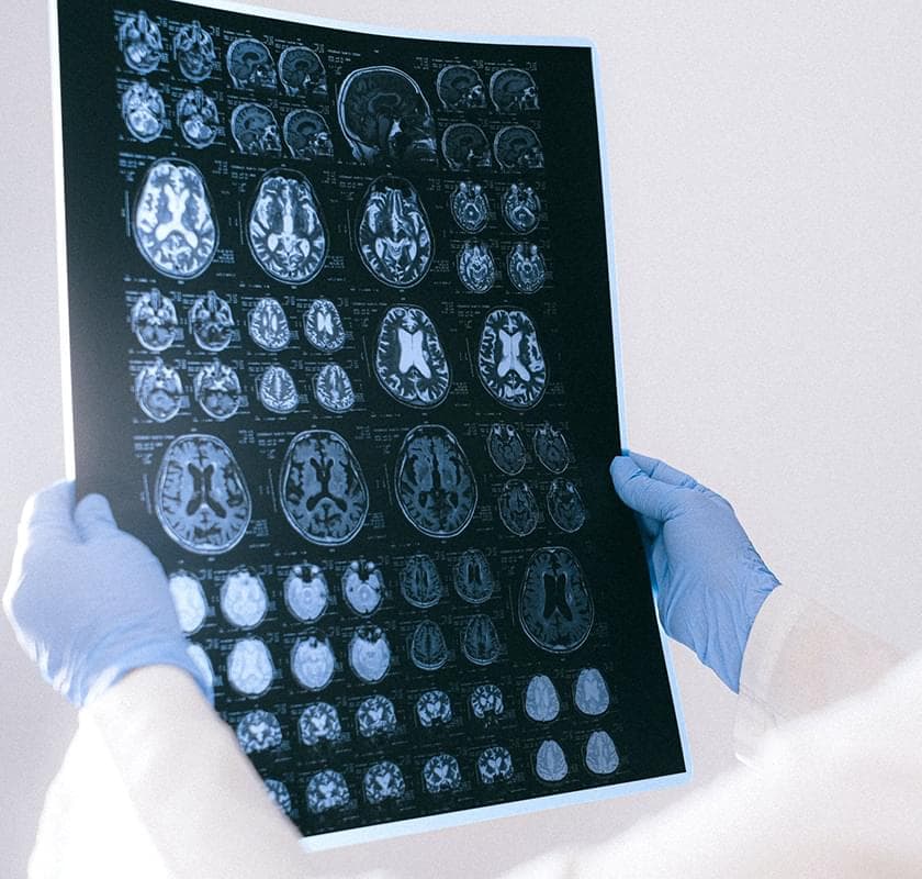 brain scans x-ray stock photo