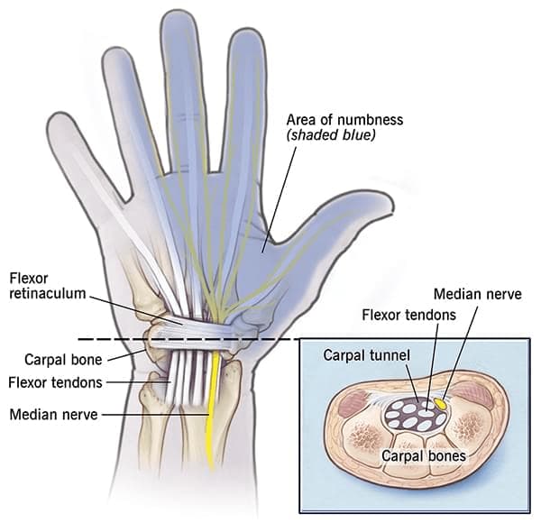 Median Nerve, Peripheral Nerve Surgery