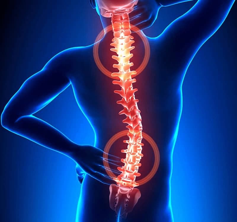 spine diagram with dark background