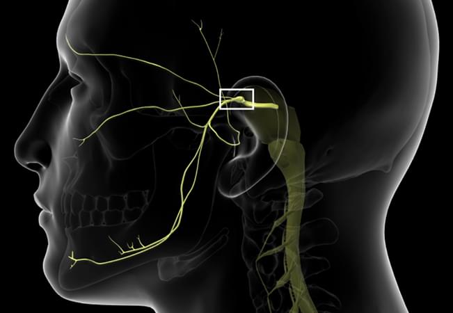 treatments for trigeminal neuralgia in tyler tx